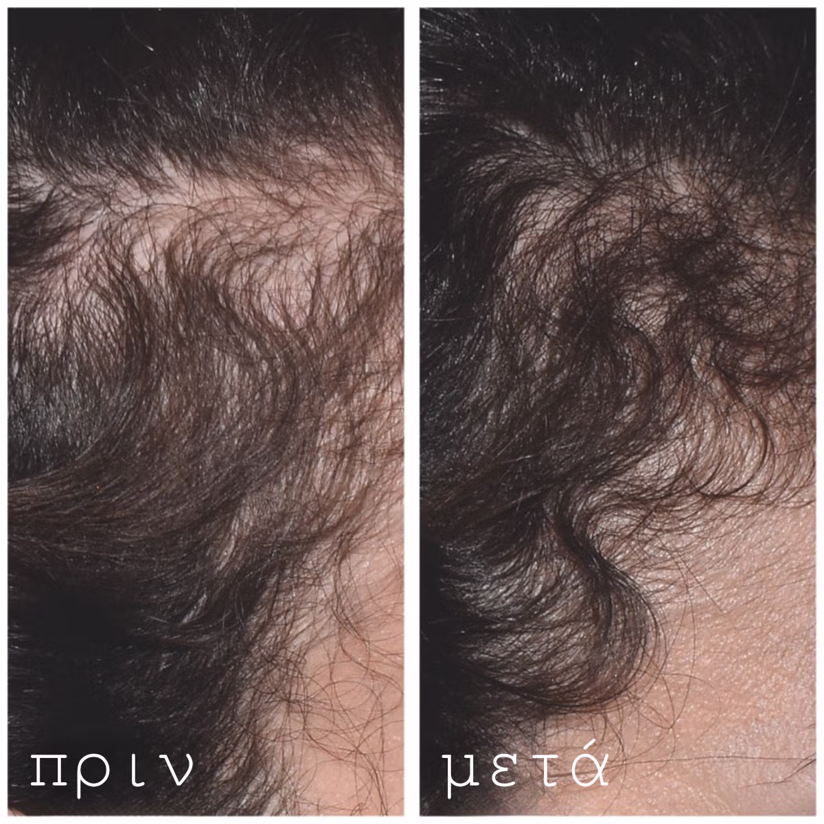 Hydrating and Post-Roller Serum