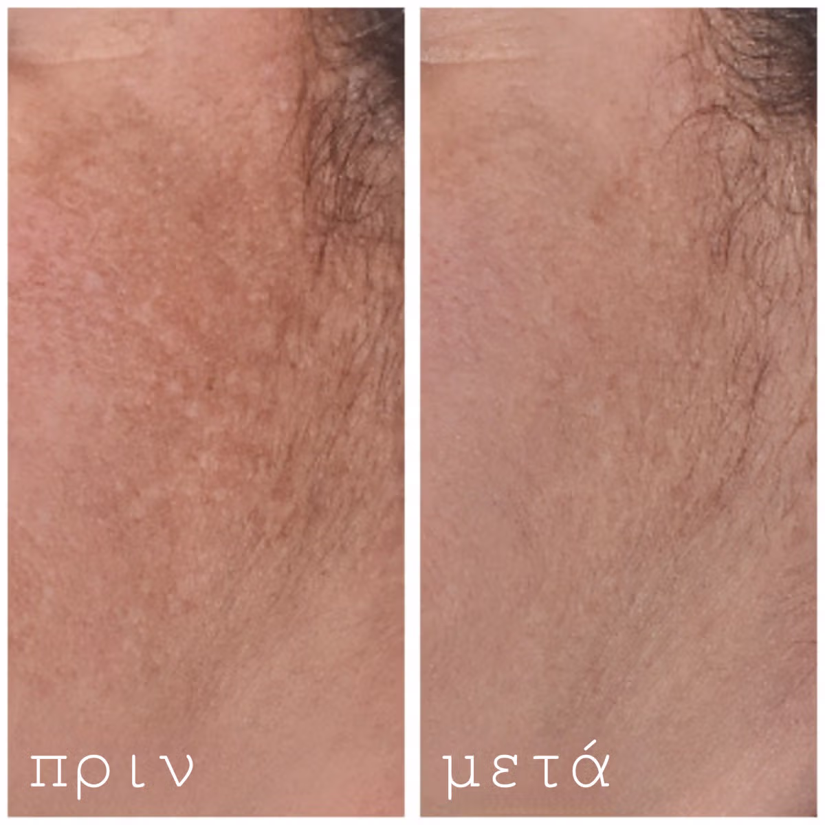 Hydrating and Post-Roller Serum