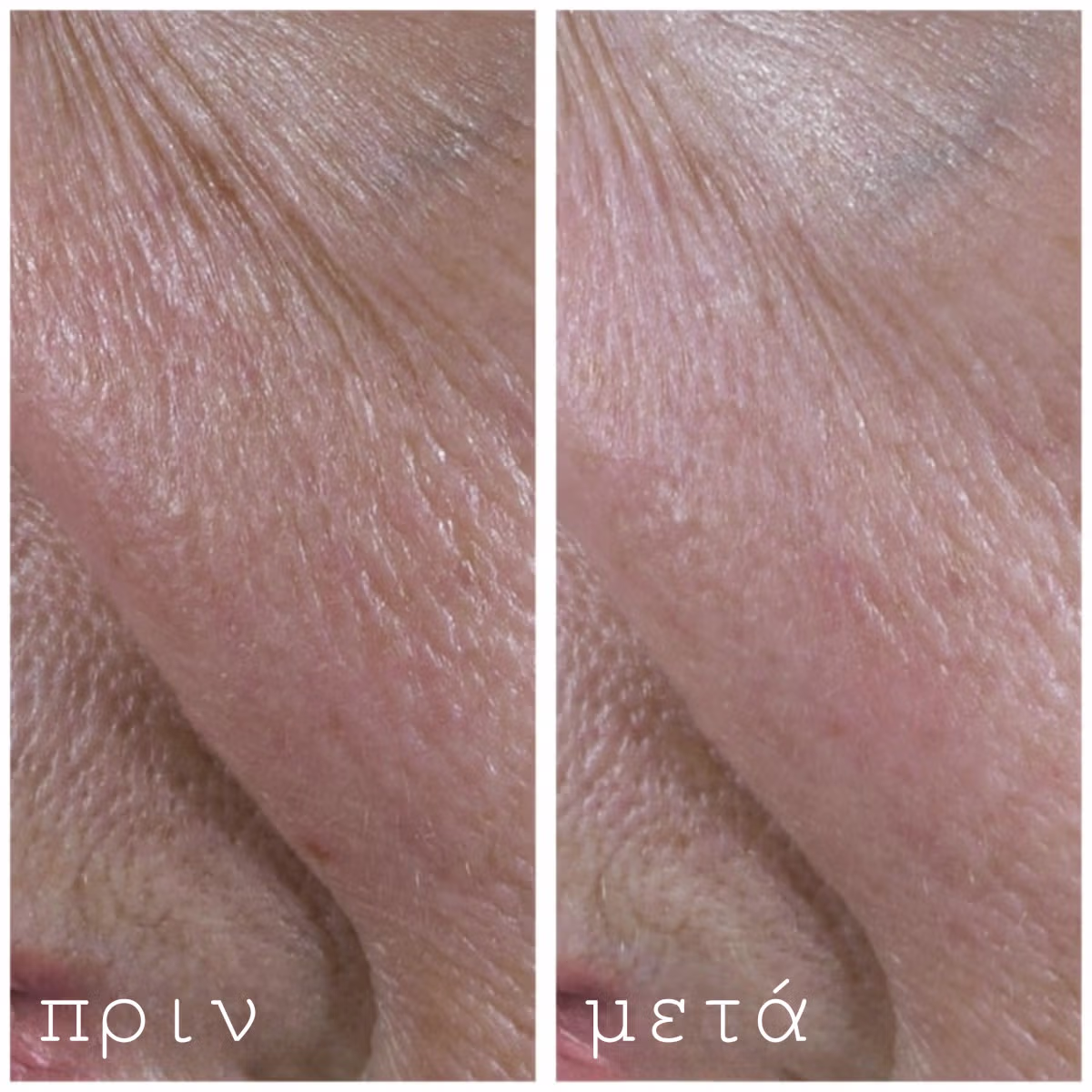 Hydrating and Post-Roller Serum