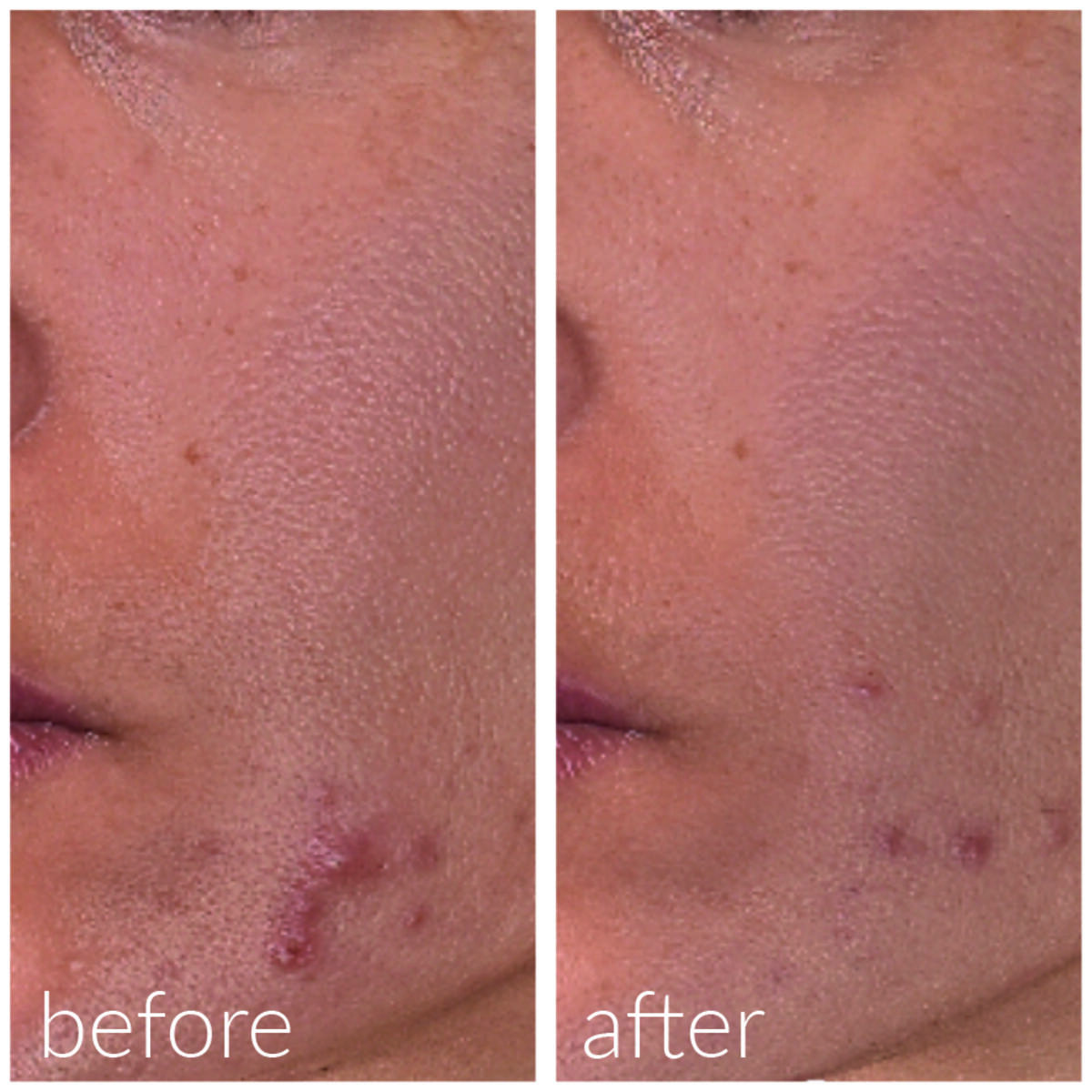 Hydrating and Post-Roller Serum