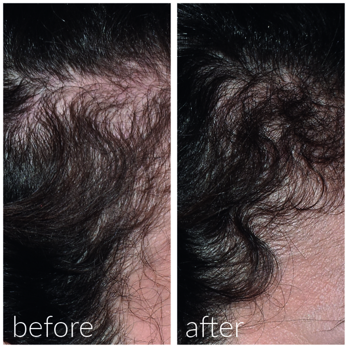 Hydrating and Post-Roller Serum