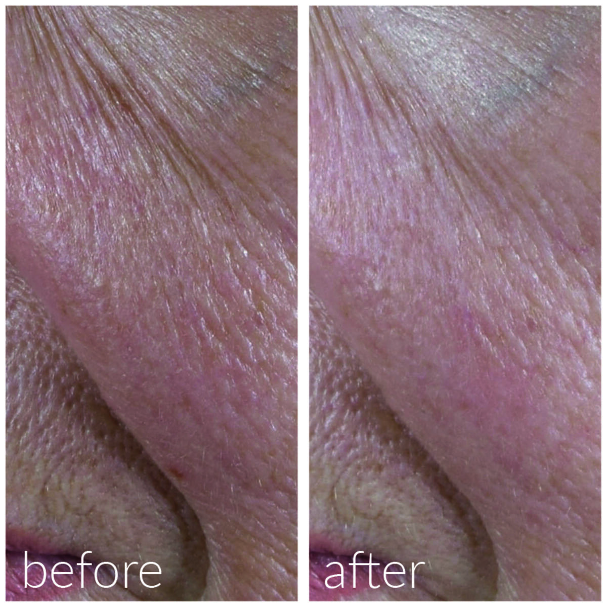 Hydrating and Post-Roller Serum