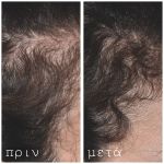 HAIR - Ορός Ενδυνάμωσης της τρίχας + Ενσωματωμένο Roller